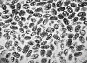 poxvirus - molluscum contagiosum